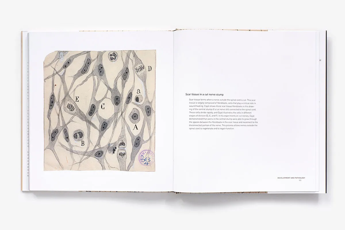 Abrams The Beautiful Brain kunstbok innbundet hjerne